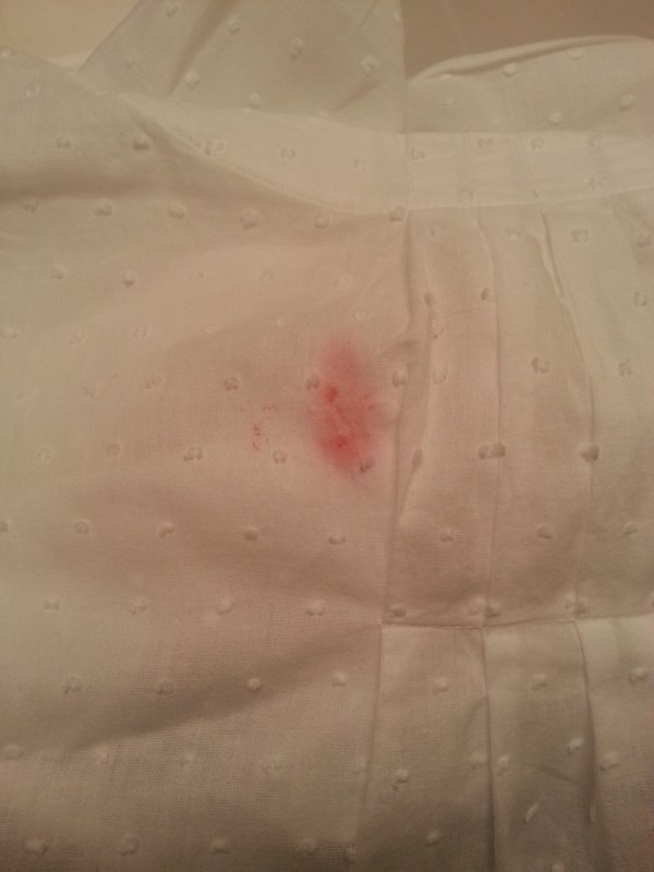 Why is it always something falling on a white shirt?